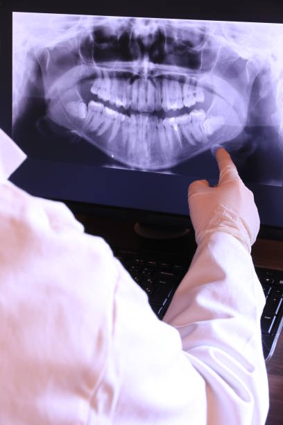 Best Knocked-Out Tooth (Avulsed Tooth) Treatment in Washington, DC